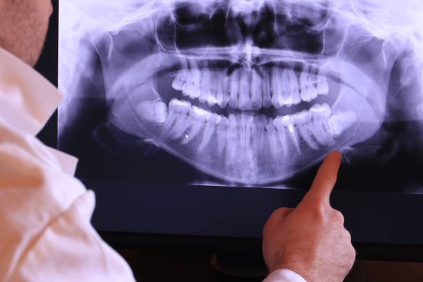 Best Broken or Chipped Tooth Repair in Girard, KS