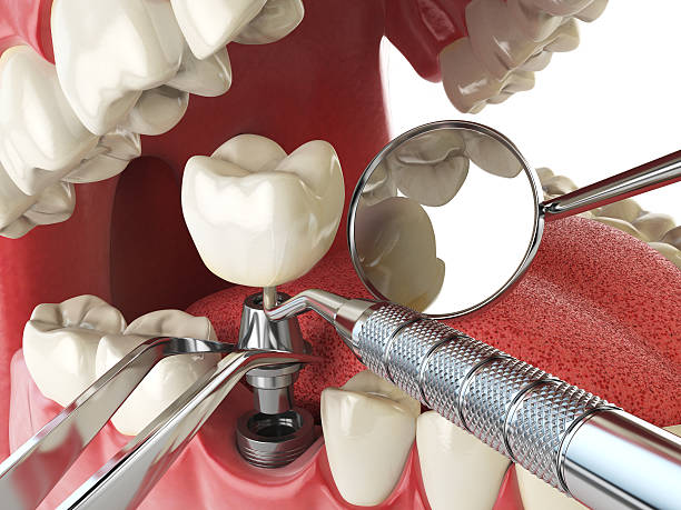 Best Walk-In Emergency Dental Services in Girard, KS